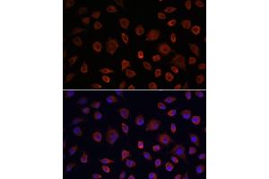 Immunofluorescence analysis of L929 cells using ULK1 antibody (ABIN6134005, ABIN6149921, ABIN6149922 and ABIN6224624) at dilution of 1:100. (ULK1 抗体  (AA 400-499))