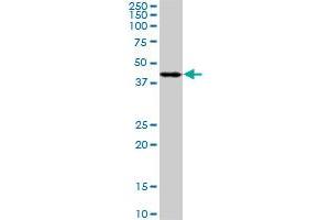 PDK2 monoclonal antibody (M02), clone 5F8. (PDK2 抗体  (AA 187-276))