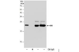 IP Image Immunoprecipitation of Bid protein from Jurkat whole cell extracts using 5 μg of Bid antibody [N1C3] , or Bid antibody [N1C3-2], Western blot analysis was performed using Bid antibody [N1C3], EasyBlot anti-Rabbit IgG  was used as a secondary reagent. (BID 抗体)