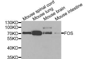 Western blot analysis of extracts of various cell lines, using FOS antibody.