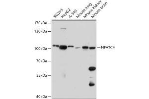 Western blot analysis of extracts of various cell lines, using NF antibody (ABIN7268979) at 1:1000 dilution. (NFATC4 抗体  (AA 560-710))