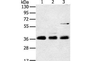 Western Blot analysis of Mouse lung tissue, NIH/3T3 and hepg2 cell using ANKRD1 Polyclonal Antibody at dilution of 1:400 (ANKRD1 抗体)