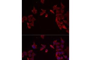 Immunofluorescence analysis of MCF7 cells using RAMP3 Polyclonal Antibody