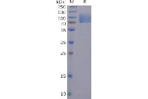 SDS-PAGE (SDS) image for SARS-CoV-2 Spike S1 (N-Term) protein (Fc Tag) (ABIN6961173)