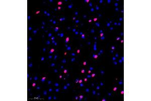 Immunofluorescence of paraffin embedded mouse brain using kb12 (ABIN7075406) at dilution of 1:700 (300x lens) (p130 抗体)