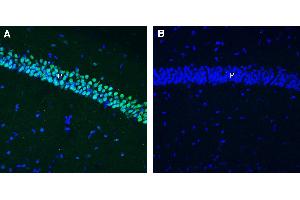 Expression of NPTX2 in mouse hippocampus.