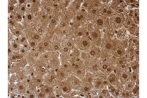 Immunohistochemistry (IHC) image for anti-Proteasome Subunit alpha 6 (PSMA6) (Center) antibody (ABIN2856913)
