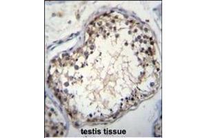 OVOS Antibody (N-term) (ABIN655570 and ABIN2845070)a immunohistochemistry analysis in formalin fixed and paraffin embedded human testis tissue followed by peroxidase conjugation of the secondary antibody and DAB staining. (OVOS1 (AA 99-128), (N-Term) 抗体)