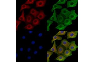 ABIN6258547 and ABIN6275031 staining Hela cells by IF/ICC. (C1QL2 抗体  (C-Term))
