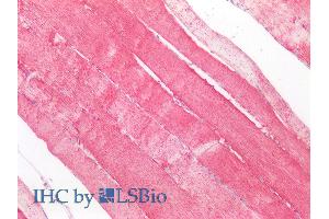ABIN768566 (5µg/ml) staining of paraffin embedded Human Skeletal Muscle. (SOD2 抗体  (AA 119-130))