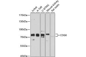 Western blot analysis of extracts of various cell lines, using COG6 antibody  at 1:1000 dilution. (COG6 抗体  (AA 508-657))