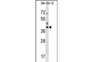 Western blot analysis in SK-BR-3 cell line lysates (35ug/lane). (HSD17B1 抗体  (C-Term))
