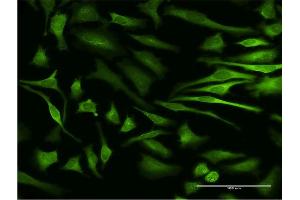 Immunofluorescence of monoclonal antibody to MAPKAPK5 on HeLa cell. (MAPKAP Kinase 5 抗体  (AA 371-471))