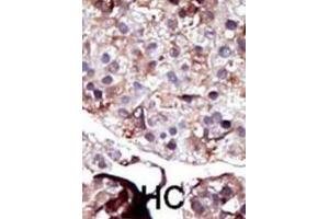 Immunohistochemistry (IHC) image for anti-Sphingosine Kinase 2 (SPHK2) antibody (ABIN3003068) (SPHK2 抗体)