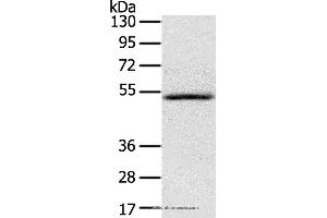Western blot analysis of Human normal liver tissue, using IL17RB Polyclonal Antibody at dilution of 1:200 (IL17 Receptor B 抗体)
