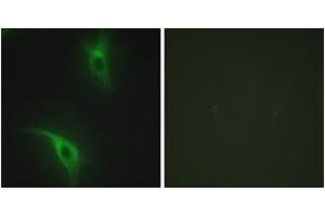 Immunofluorescence analysis of HeLa cells, using CKS1 Antibody. (CKS1 抗体  (AA 10-59))