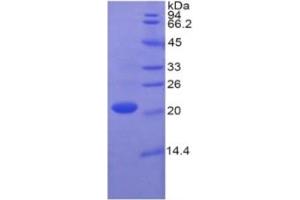 SDS-PAGE of Protein Standard from the Kit (Highly purified E. (Caspase 1 ELISA 试剂盒)