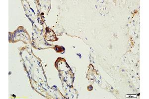 Formalin-fixed and paraffin embedded human placenta tissue labeled with Anti-Factor XIII Polyclonal Antibody, Unconjugated (ABIN731738) at 1:200 followed by conjugation to the secondary antibody, (SP-0023), and DAB staining (Factor XIII 抗体  (AA 331-732))