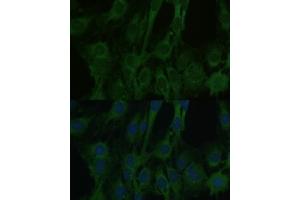Immunofluorescence analysis of C6 cells using F antibody (ABIN6129530, ABIN6140428, ABIN6140430 and ABIN6215290) at dilution of 1:100. (FABP7 抗体  (AA 1-132))