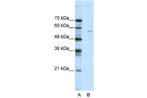 WB Suggested Anti-ELK1  Antibody Titration: 2. (ELK1 抗体  (N-Term))