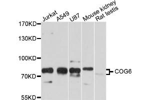 Western blot analysis of extracts of various cell lines, using COG6 antibody (ABIN5997476) at 1/1000 dilution. (COG6 抗体)