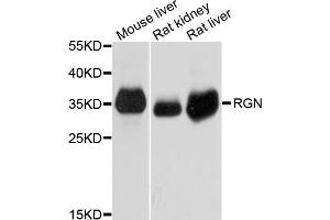 Western blot analysis of extracts of various cell lines, using RGN antibody. (Regucalcin 抗体)