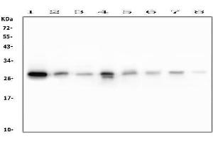 Western blot analysis of RAB27A using anti-RAB27A antibody (ABIN7602714).