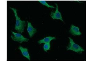 ICC/IF analysis of LYVE-1 in A549 cells line, stained with DAPI (Blue) for nucleus staining and monoclonal anti-human LYVE-1 antibody (1:100) with goat anti-mouse IgG-Alexa fluor 488 conjugate (Green). (LYVE1 抗体  (AA 25-235))