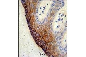 Formalin-fixed and paraffin-embedded human skin tissue reacted with ECE-1 Antibody (C-term), which was peroxidase-conjugated to the secondary antibody, followed by DAB staining. (ECE1 抗体  (AA 528-556))
