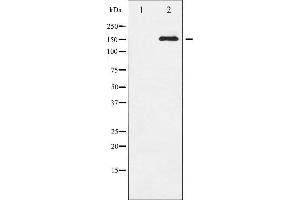 Western blot analysis of EGFR phosphorylation expression in serum treated HepG2 whole cell lysates,The lane on the left is treated with the antigen-specific peptide. (EGFR 抗体  (pSer1071))
