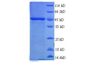 SDS-PAGE (SDS) image for SWI/SNF Related, Matrix Associated, Actin Dependent Regulator of Chromatin, Subfamily B, Member 1 (SMARCB1) (AA 2-376), (partial) protein (His tag) (ABIN5714344)