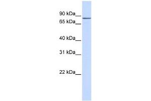 ZNF420 antibody used at 1 ug/ml to detect target protein. (ZNF420 抗体  (N-Term))
