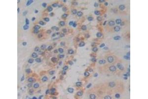 Used in DAB staining on fromalin fixed paraffin- embedded Kidney tissue (CCDC60 抗体  (AA 388-520))