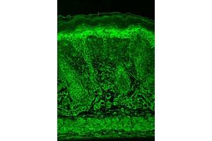 Immunohistochemistry (IHC) image for anti-Hypoxia Inducible Factor 1, alpha Subunit (Basic Helix-Loop-Helix Transcription Factor) (HIF1A) (AA 329-530) antibody (Biotin) (ABIN2484781)