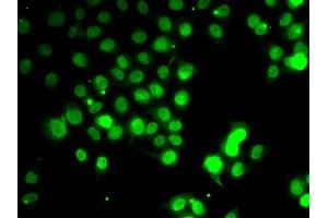 Immunofluorescence analysis of HeLa cells using GABARAP antibody (ABIN6134237, ABIN6140873, ABIN6140876 and ABIN6217999). (GABARAP 抗体  (AA 1-100))