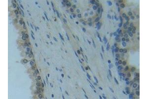 Detection of Raftlin in Human Prostate Tissue using Polyclonal Antibody to Raft Linking Protein (Raftlin) (RFTN1 抗体  (AA 288-520))