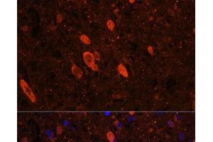 Immunofluorescence (IF) image for anti-ELAV-Like 3 (ELAVL3) antibody (ABIN7261946)