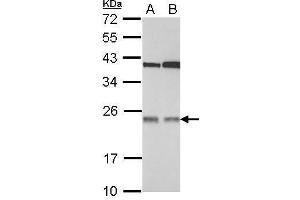 WB Image Sample (30 ug of whole cell lysate) A: 293T B: A431 12% SDS PAGE antibody diluted at 1:1000 (TMED7 抗体  (Center))