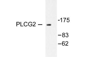 Image no. 1 for anti-Phospholipase C gamma 2 (PLCG2) antibody (ABIN271905) (Phospholipase C gamma 2 抗体)