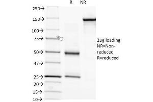 SDS-PAGE Analysis of Purified anti-Biotin Mouse Monoclonal antibody (Hyb-8). (Biotin 抗体)