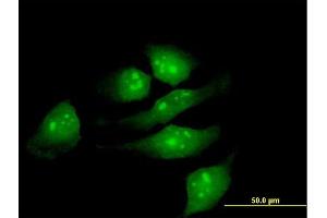 Immunofluorescence of purified MaxPab antibody to METTL2 on HeLa cell. (METTL2B 抗体  (AA 1-313))