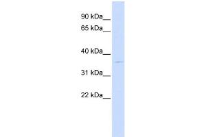 WB Suggested Anti-PGBD2 Antibody Titration: 0. (PGBD2 抗体  (Middle Region))