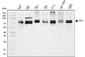 Western blot analysis of splicing factor 1 using anti-splicing factor 1 antibody (ABIN7600194).