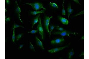 Immunofluorescence staining of U251 cells with ABIN7143857 at 1:66, counter-stained with DAPI. (CRYAB 抗体  (AA 1-175))