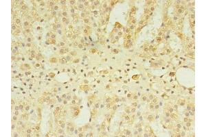 Immunohistochemistry of paraffin-embedded human adrenal gland tissue using ABIN7147640 at dilution of 1:100 (CSGALNACT2 抗体  (AA 33-270))