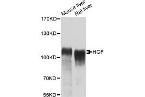 Western blot analysis of extracts of various cell lines, using HGF antibody. (HGF 抗体)