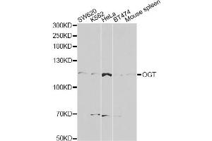 Western blot analysis of extracts of various cell lines, using OGT antibody (ABIN5998410) at 1/1000 dilution. (OGT 抗体)