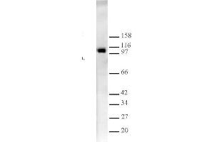 Western Blotting (WB) image for anti-Lysine (K)-Specific Demethylase 1A (KDM1A) antibody (ABIN577699) (LSD1 抗体)