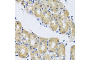Immunohistochemistry of paraffin-embedded human gastric using DYNC1I1 antibody at dilution of 1:100 (x40 lens). (DYNC1I1 抗体)