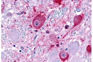 Anti-NPY1R antibody  ABIN1049121 IHC staining of human brain. (NPY1R 抗体  (Extracellular Domain))